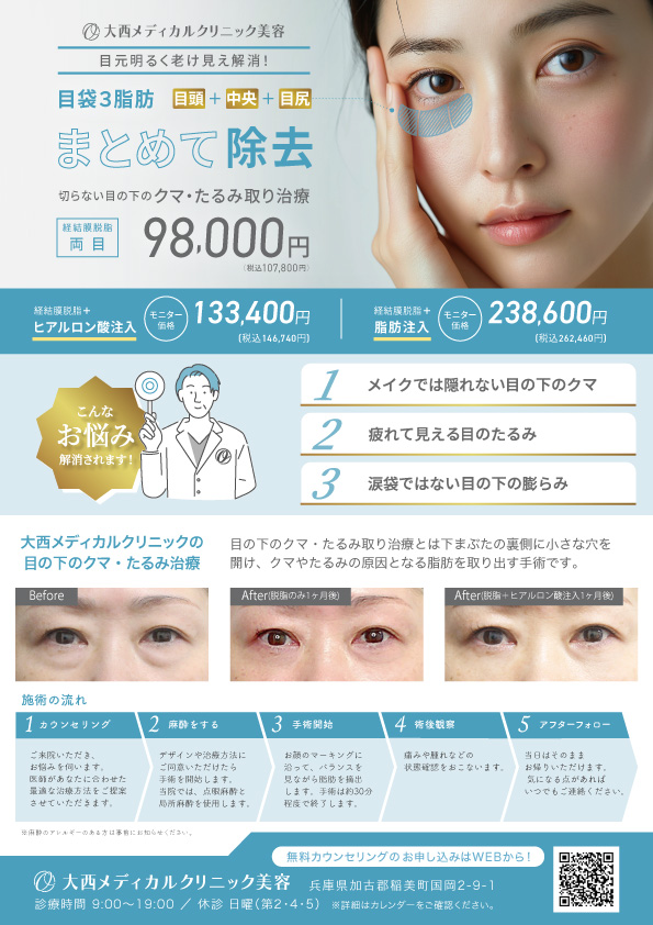 美容クリニック　クマ取り　A4チラシ